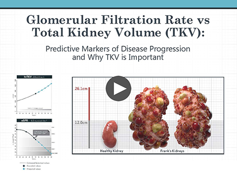 Glomerular Filtration Rate vs Total Kidney Volume (TKV)